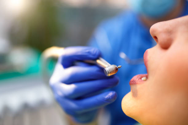 Dental Bonding in Angleton, TX